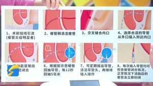 导尿管正确使用方法，安全又舒适（腹肌小奶狗导管正确使用方法）