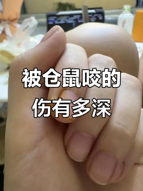 小仓鼠咬伤别大意，正确处理防感染（被家里养的小仓鼠咬了）