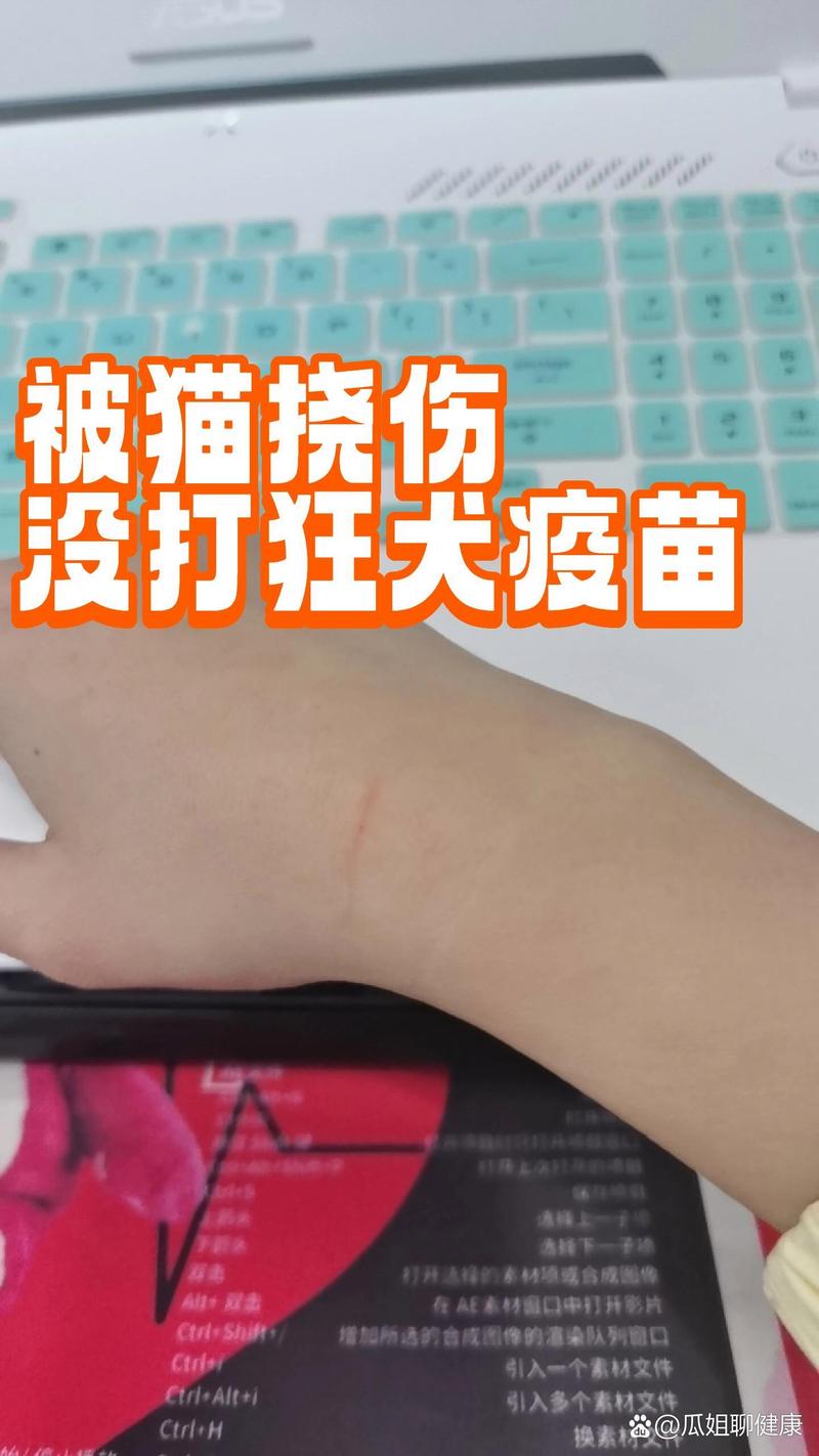 被猫挠伤？别慌！正确处理看这里！（被猫挠了没事吧）