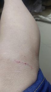 小狗咬伤留牙印，及时清洗消毒并考虑打疫苗（小狗咬了个牙印没事吧）