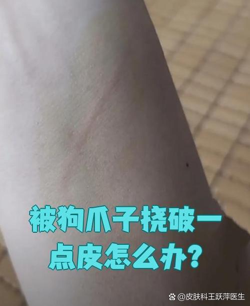 狗抓伤皮要当心，冲消毒打疫苗！（狗爪子抓破一点点皮要紧吗）