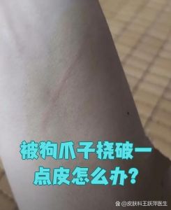 狗抓伤皮要当心，冲消毒打疫苗！（狗爪子抓破一点点皮要紧吗）