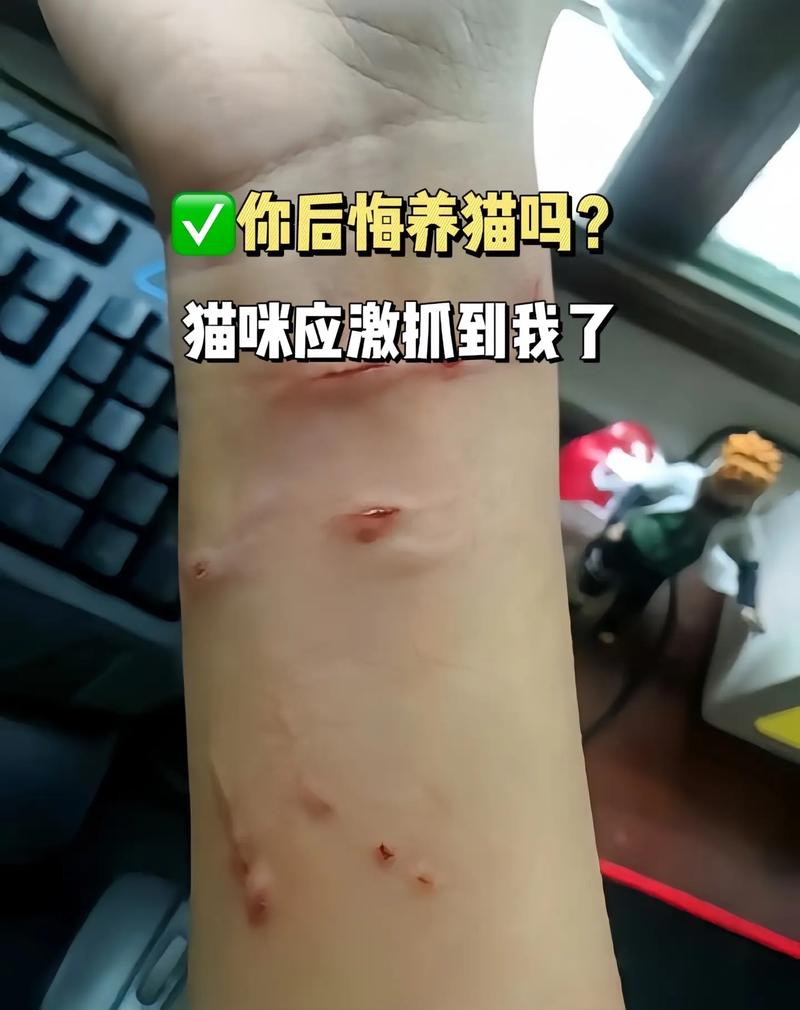 猫抓出血要当心,看疫苗处理伤口(家里养的猫挠了没事吧) 猫抓出血要当心,看疫苗处理伤口(家里养的猫挠了没事吧)