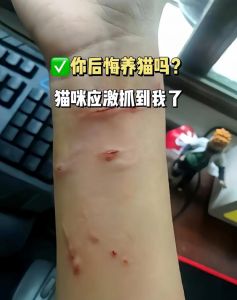 猫抓出血要当心，看疫苗处理伤口（家里养的猫挠了没事吧）