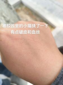 猫抓伤别慌，水洗消毒打疫苗！（被猫挠了怎么办）