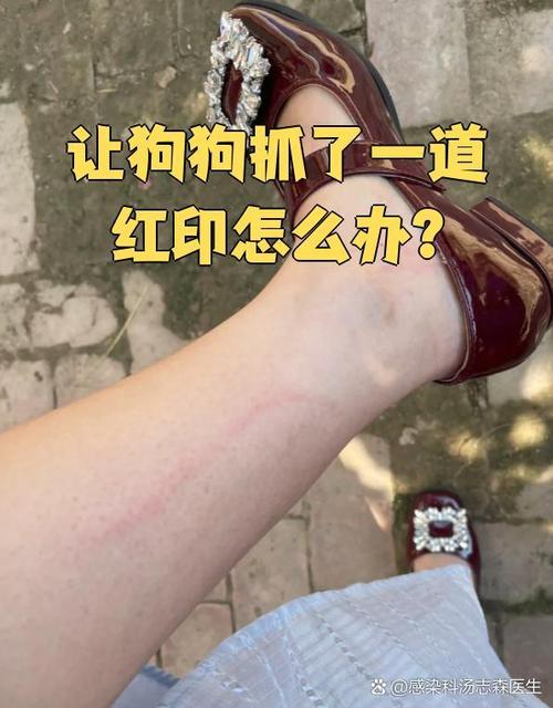 狗抓伤要当心，伤口清洗并观察狗（被自己养的狗抓伤了要紧吗）