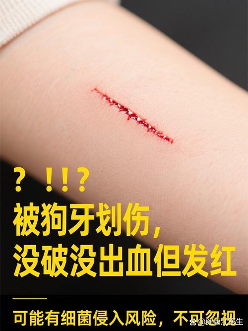 小狗划伤皮肤，别忽视，速冲消毒打疫苗！（被自家小狗划破皮没血）