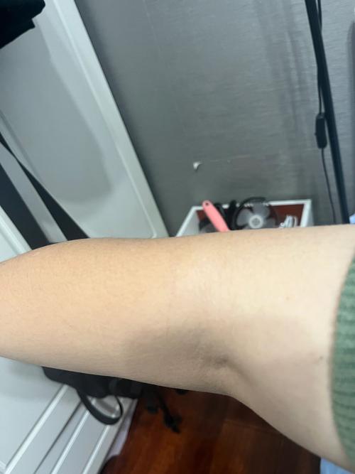 猫咪爪伤虽小要当心,及时处理判断是否就医(不小心被家养的猫划出了一毫米的口子) 猫咪爪伤虽小要当心,及时处理判断是否就医(不小心被家养的猫划出了一毫米的口子)