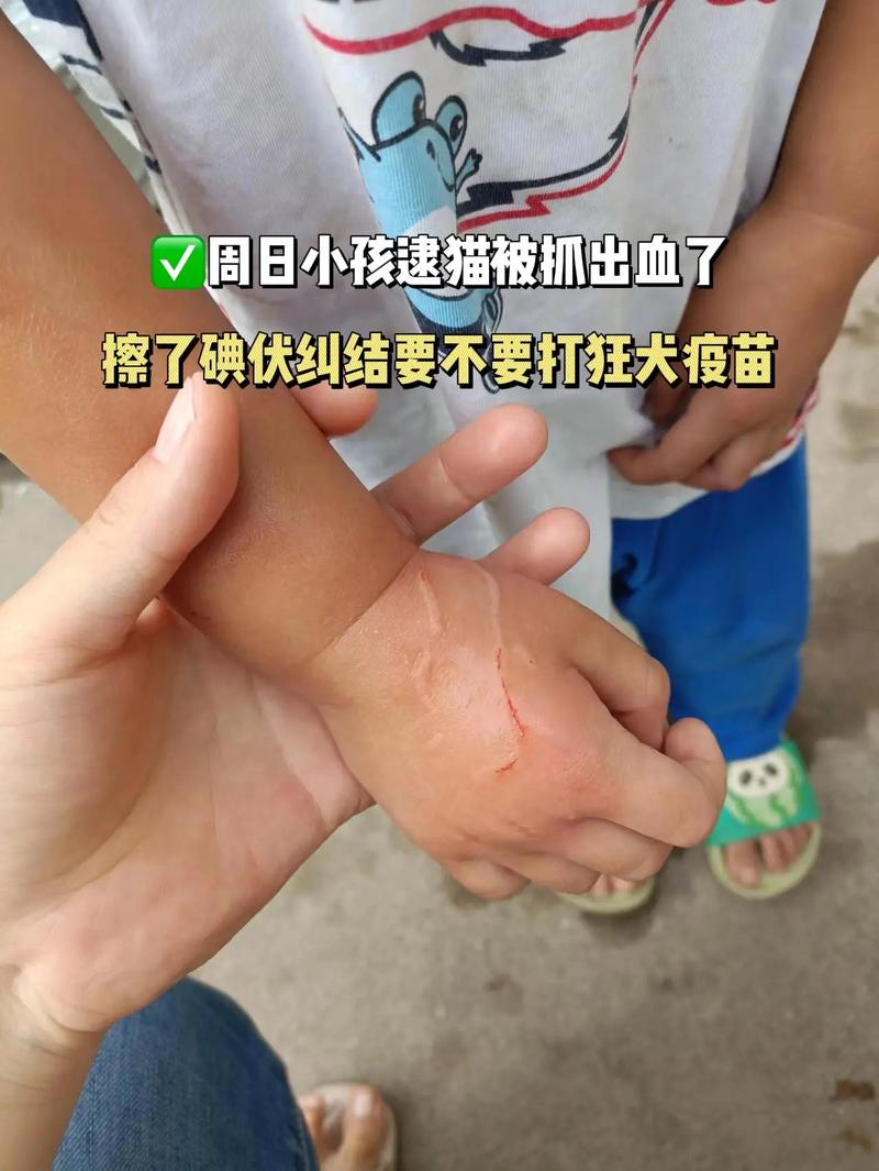 小猫抓伤别大意,及时处理防感染(家里养的小猫挠了有事吗) 小猫抓伤别大意,及时处理防感染(家里养的小猫挠了有事吗)