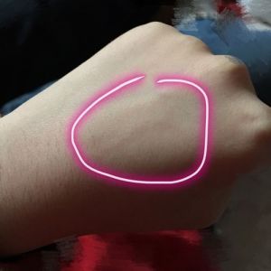 被狗刮伤怎么办？正确处理步骤（被宠物狗轻轻刮了一下）