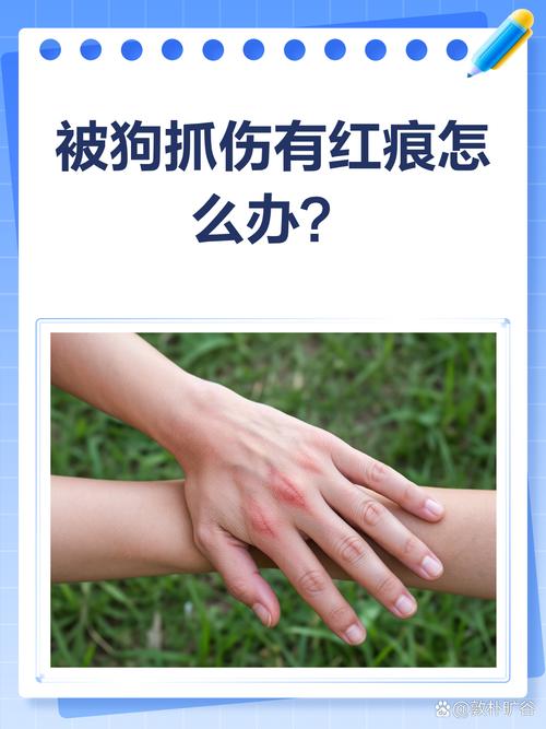 狗抓伤皮肤要当心，及时处理防感染（被宠物狗抓破了有事吗）