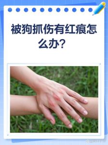 狗抓伤皮肤要当心，及时处理防感染（被宠物狗抓破了有事吗）