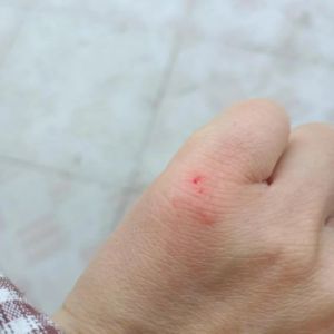 狗狗划伤怎么办？伤口处理与注意事项（狗被划了一个伤口怎么办啊）