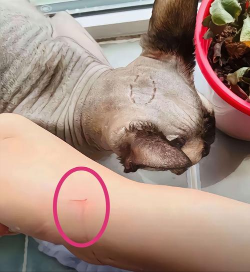 猫抓伤出血怎么办？速冲消毒，深伤口快就医！（被正常的家养猫抓到了一下）