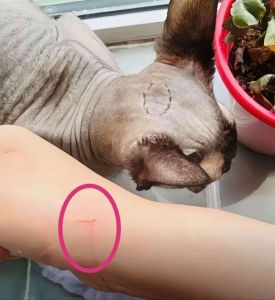 猫抓伤出血怎么办？速冲消毒，深伤口快就医！（被正常的家养猫抓到了一下）
