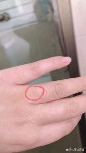 猫抓伤出血要不要打疫苗？看伤口和猫！（猫抓了一下要打针吗）
