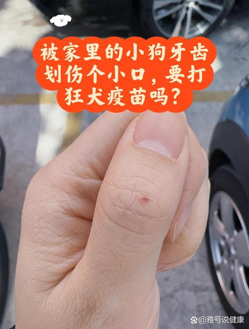 狗抓伤皮肤怎么办？速处理就医！（不小心被小狗划破皮了）