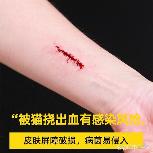 猫抓伤出血要当回事，及时冲洗消毒，遵医嘱！（家养的猫抓了一下出血了要紧吗）