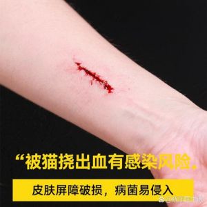 猫抓伤出血要当回事，及时冲洗消毒，遵医嘱！（家养的猫抓了一下出血了要紧吗）