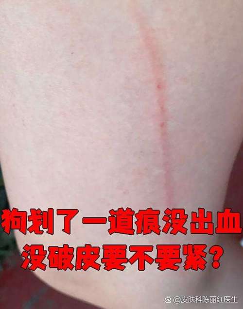 被狗咬伤？肥皂水冲洗消毒，注意观察狂犬！（小狗不小心划破皮需要怎么弄）