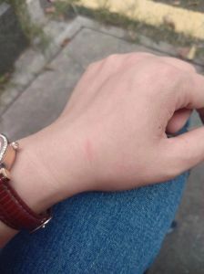 狗爪划伤红印别忽视，冲洗消毒防感染，红肿持续速就医（被家里狗狗的爪子划了几道红印）