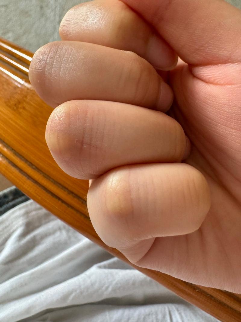 家猫抓伤及时消毒，出血就医，注意观察防狂犬（家养小猫3个月被挠一下）