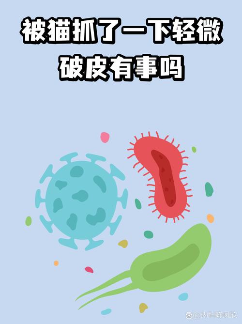 猫抓伤虽小伤，清洁消毒别忘掉（被猫轻微抓了一下）