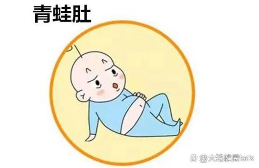蛙状腹是什么病?需警惕!(蛙腹图片) 蛙状腹是什么病?需警惕!(蛙腹图片)