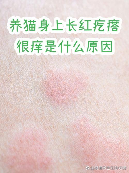 减少猫毛过敏,家居清洁和互动防护(猫毛过敏怎么缓解) 减少猫毛过敏,家居清洁和互动防护(猫毛过敏怎么缓解)
