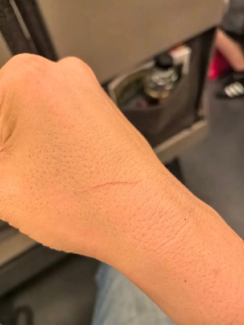 布偶猫抓伤后处理与疫苗防疫(布偶被野橘猫抓伤爪子) 布偶猫抓伤后处理与疫苗防疫(布偶被野橘猫抓伤爪子)