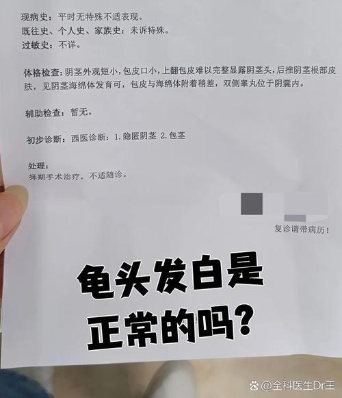 龟头白斑原因多,注意清洁防感染(龟的头上有白斑是怎么回事) 龟头白斑原因多,注意清洁防感染(龟的头上有白斑是怎么回事)