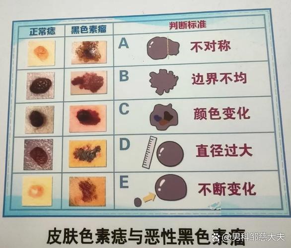 注意这些健康小信号(龟的头上长了黑斑图片) 注意这些健康小信号(龟的头上长了黑斑图片)