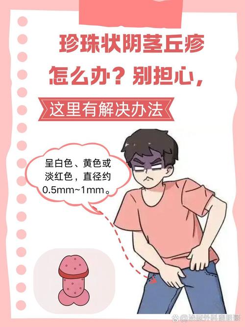 珍珠状小疙瘩,一般无需治疗(龟的头上珍珠疹图片) 珍珠状小疙瘩,一般无需治疗(龟的头上珍珠疹图片)