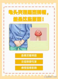 龟头黑斑不痛不痒？快查原因！（龟 头上有黑斑不痛不痒怎么回事）