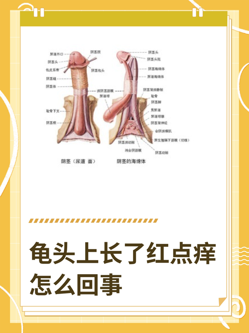 龟头红斑是什么原因引起的?(龟的头上长了红斑图片) 龟头红斑是什么原因引起的?(龟的头上长了红斑图片)