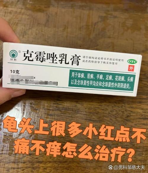 龟头湿疹症状多样,需综合治疗(龟 头上湿疹图片) 龟头湿疹症状多样,需综合治疗(龟 头上湿疹图片)