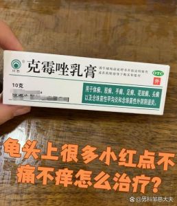 龟头湿疹症状多样，需综合治疗（龟 头上湿疹图片）