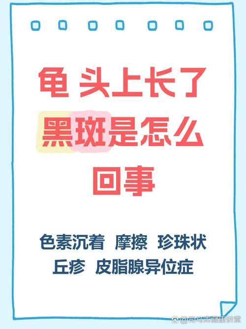 注意这些健康小信号(龟的头上长了黑斑图片) 注意这些健康小信号(龟的头上长了黑斑图片)