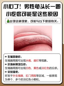 龟头小疙瘩是什么？快速自查男女常见原因（男生龟的头上长一圈小疙瘩是什么）