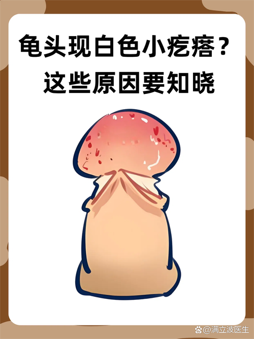 龟头湿疹症状多样,需综合治疗(龟 头上湿疹图片) 龟头湿疹症状多样,需综合治疗(龟 头上湿疹图片)