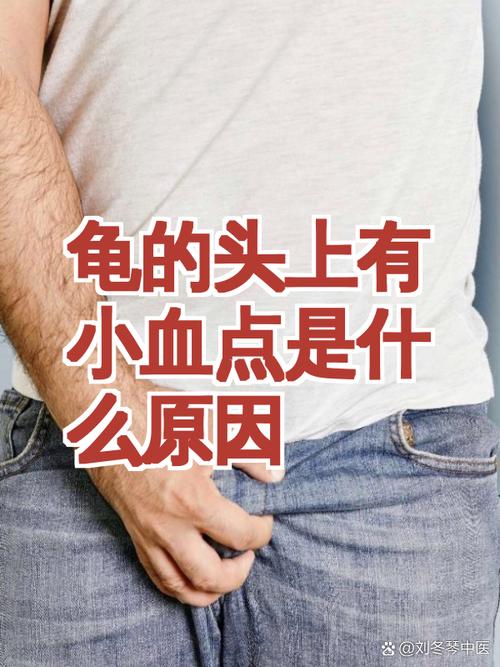 龟头红点?炎症惹的祸,及时就医早治疗!(龟的头上有小红点图片) 龟头红点?炎症惹的祸,及时就医早治疗!(龟的头上有小红点图片)