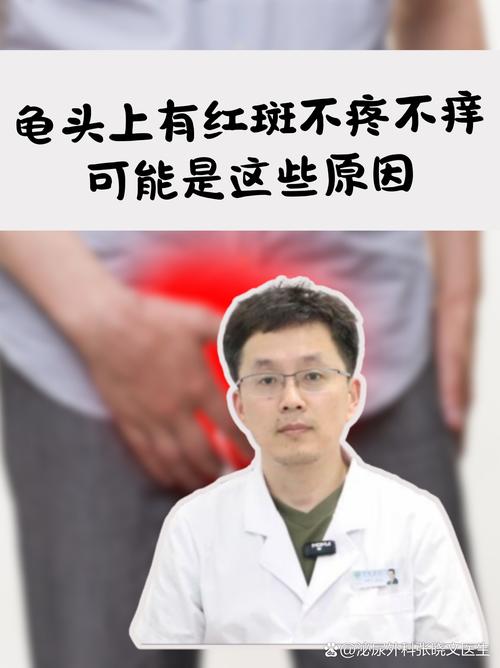 龟头红斑是什么原因引起的?(龟的头上长了红斑图片) 龟头红斑是什么原因引起的?(龟的头上长了红斑图片)