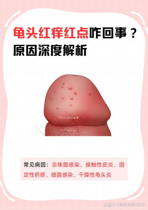龟头红点?别慌,快看医生!(龟的头上长了红点怎么回事) 龟头红点?别慌,快看医生!(龟的头上长了红点怎么回事)
