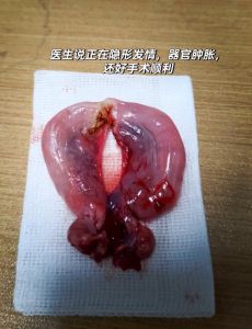 母猫绝育费用地区差异大，大城市1000-3000元，小城市300-800元（母猫咪绝育手术多少钱）