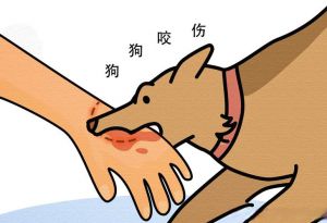 小狗咬伤喉咙怎么办？（小狗咬人捅嗓子眼没事吧）