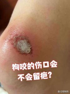 小狗咬破手怎么办？需消毒就医防狂犬（结了疤的手被小狗咬着玩没事吧）
