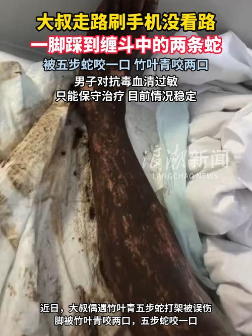 男子被双蛇咬伤，直播主林岩虚拟困境引发思考（男子遇竹叶青五步蛇打架）