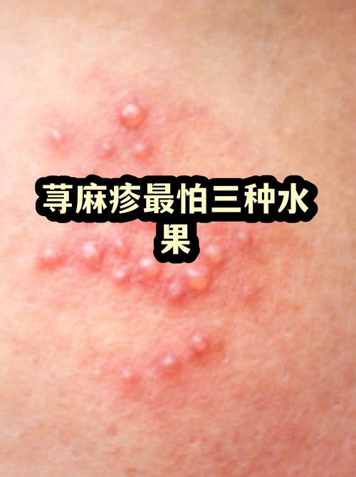 龟头敏感高？冷水摩擦刺激物惹的祸！（龟敏最怕的三个东西）